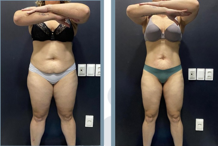 WhatsApp Image 2026-03-19 at 23.31.30