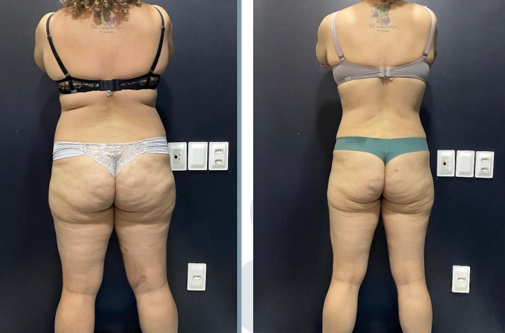 WhatsApp Image 2026-03-19 at 23.32.37