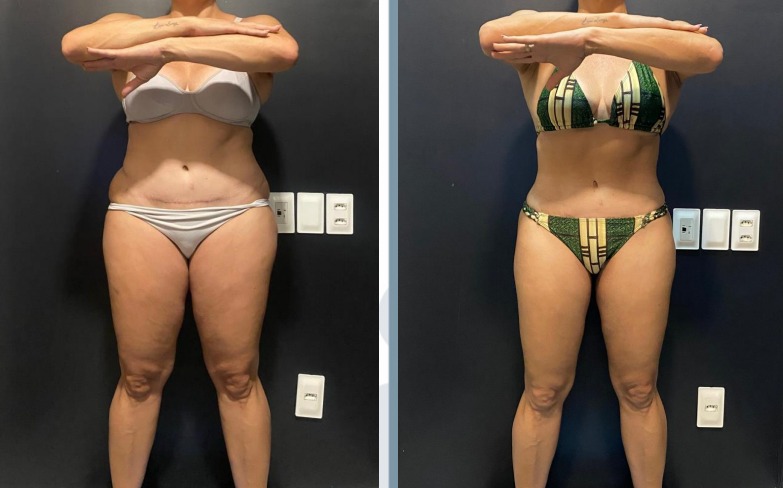 WhatsApp Image 2026-03-19 at 23.36.57